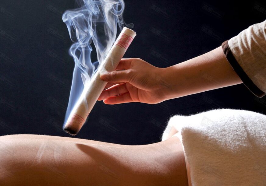 Ai Jiu, moxibustion, une méthode aussi ancienne que l'acupuncture